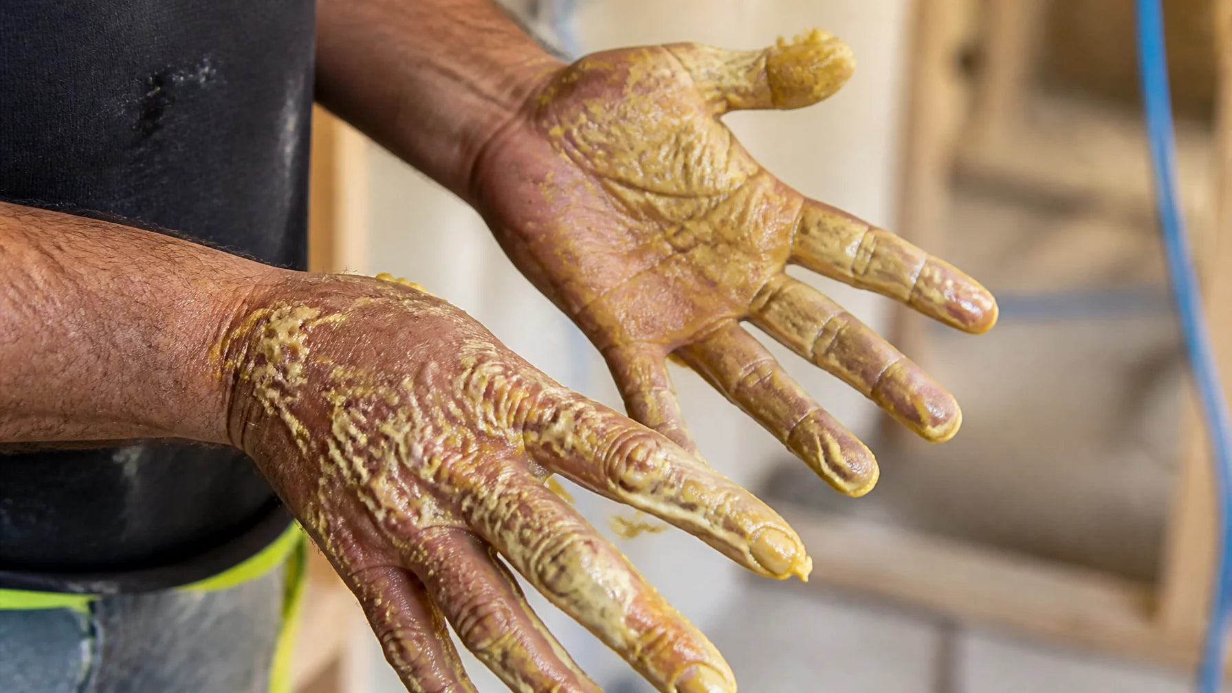 Removing dried spray foam from hands without acetone or sandpaper